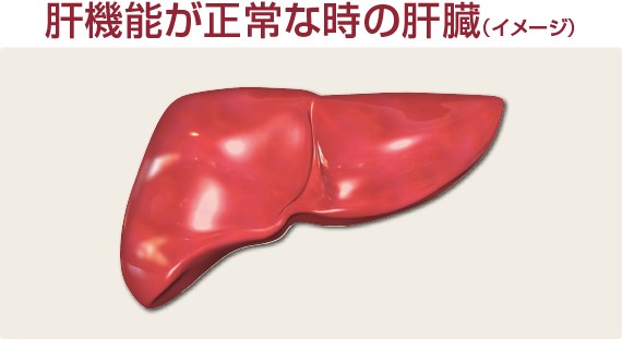 肝機能が正常な時の肝臓（イメージ）